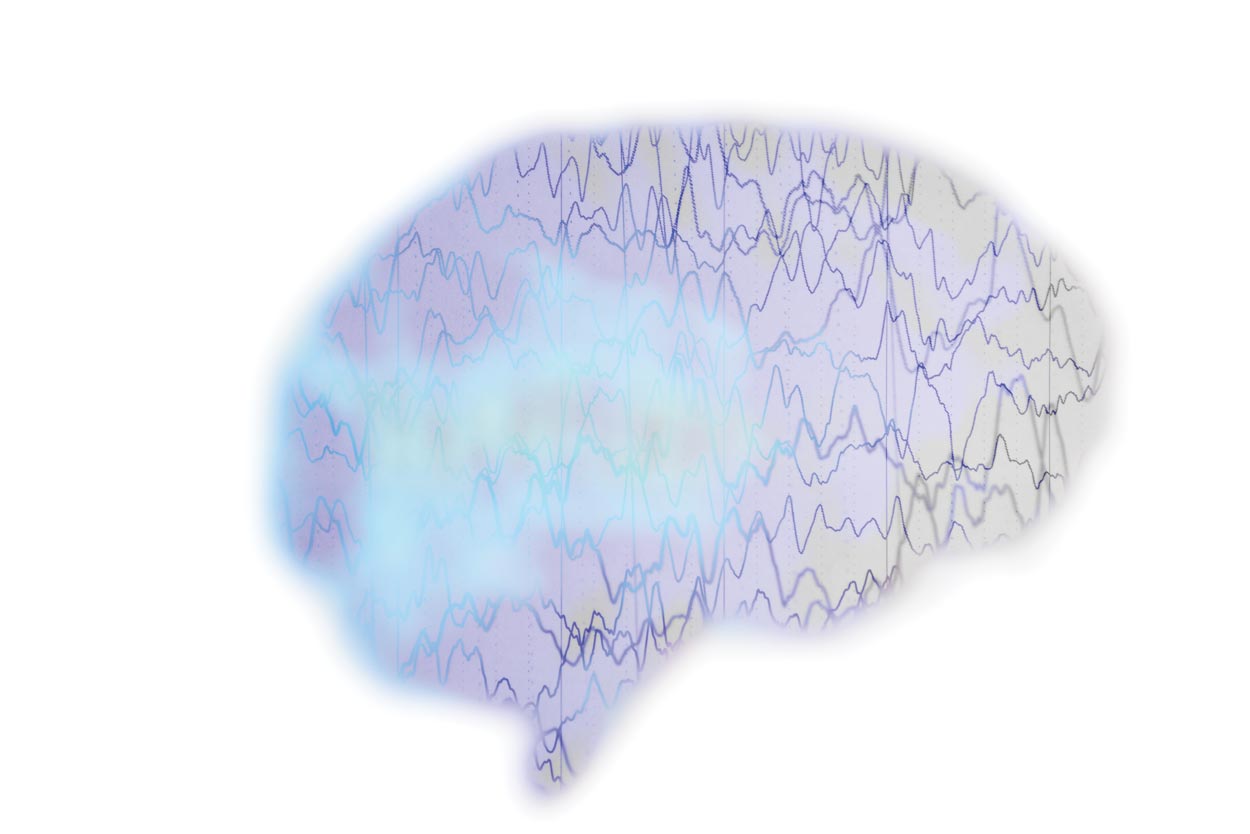 brain with graph lines and cloud inside
