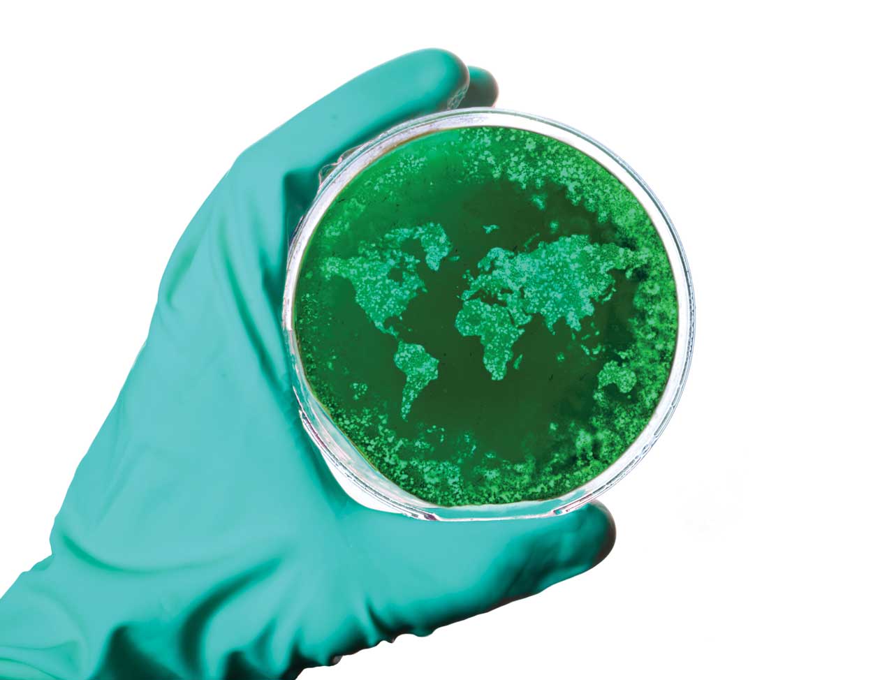petri dish with bacteria that look like the world map